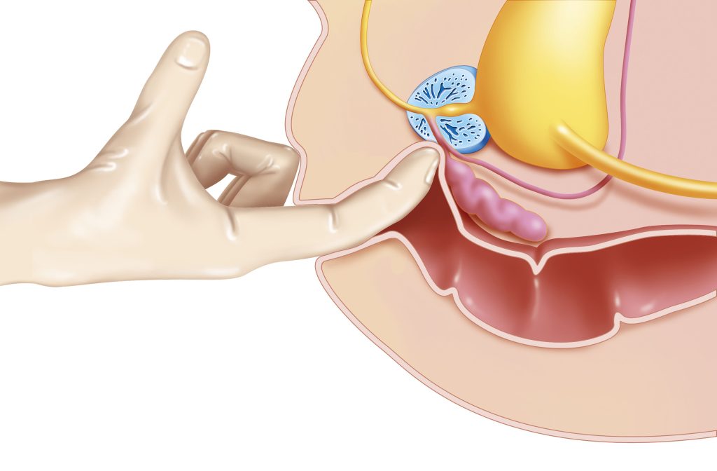 Squirt masculin et orgasme prostatique : explications et distinctions essentielles | Désirs coquins